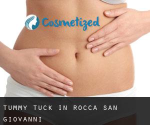 Tummy Tuck in Rocca San Giovanni