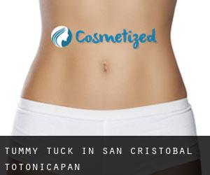 Tummy Tuck in San Cristóbal Totonicapán