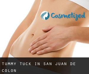 Tummy Tuck in San Juan de Colón