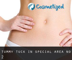 Tummy Tuck in Special Area No. 2