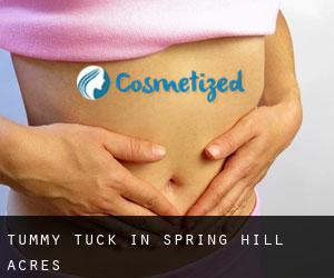 Tummy Tuck in Spring Hill Acres