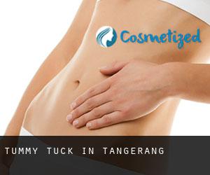 Tummy Tuck in Tangerang