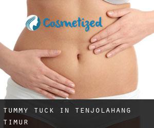 Tummy Tuck in Tenjolahang Timur