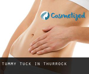 Tummy Tuck in Thurrock Tummy Tuck in Thurrock