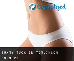 Tummy Tuck in Tomlinson Corners