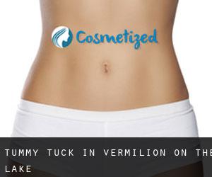 Tummy Tuck in Vermilion-on-the-Lake