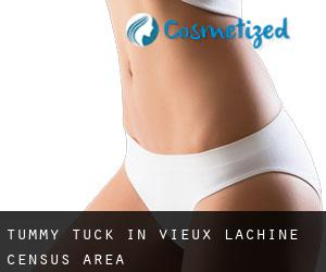 Tummy Tuck in Vieux-Lachine (census area)