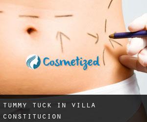 Tummy Tuck in Villa Constitución