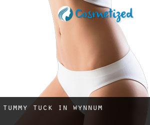 Tummy Tuck in Wynnum