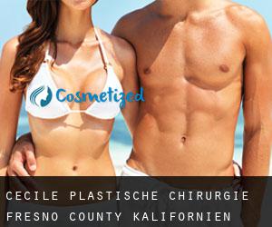 Cecile plastische chirurgie (Fresno County, Kalifornien)