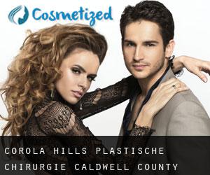 Corola Hills plastische chirurgie (Caldwell County, North Carolina)