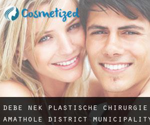 Debe Nek plastische chirurgie (Amathole District Municipality, Eastern Cape)