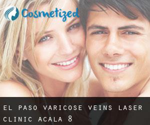 El Paso Varicose Veins Laser Clinic (Acala) #8