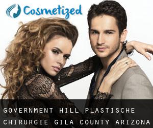 Government Hill plastische chirurgie (Gila County, Arizona)