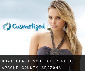 Hunt plastische chirurgie (Apache County, Arizona)
