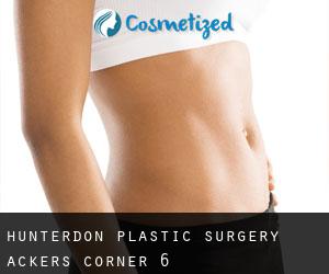 Hunterdon Plastic Surgery (Ackers Corner) #6