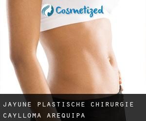 Jayune plastische chirurgie (Caylloma, Arequipa)
